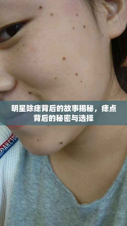 明星除痣背后的故事揭秘,痣点背后的秘密与选择